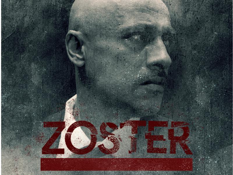 zoster